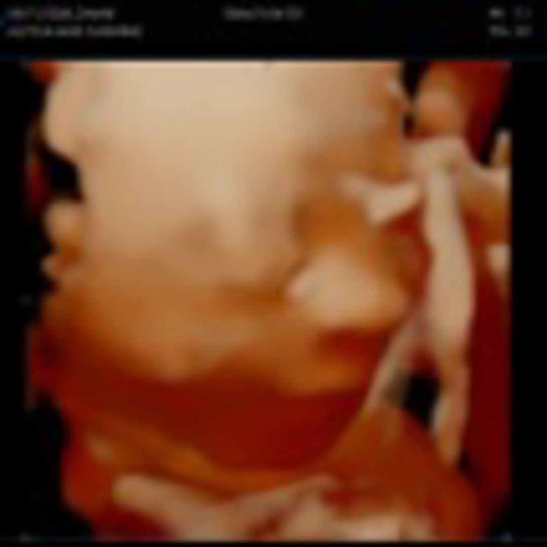 Photo shared by Alyssa for their Babylist baby registry.