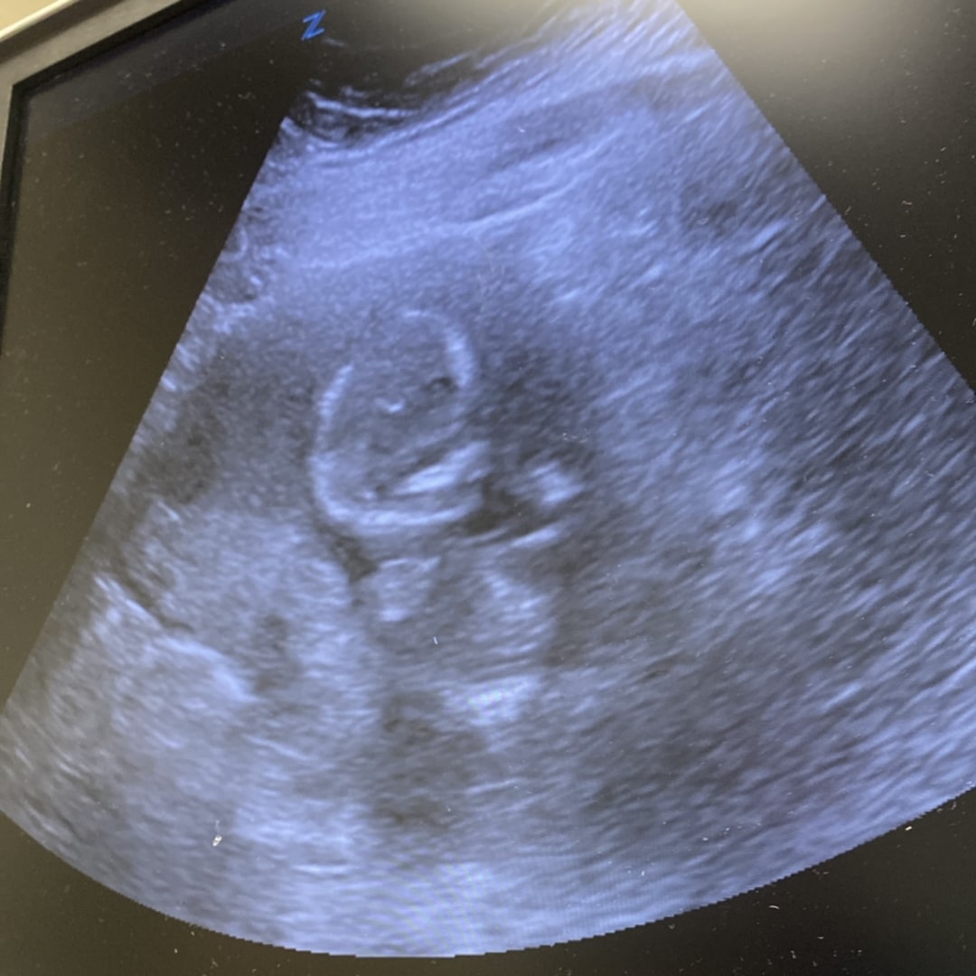 Photo shared by Esmeralda for their Babylist baby registry.