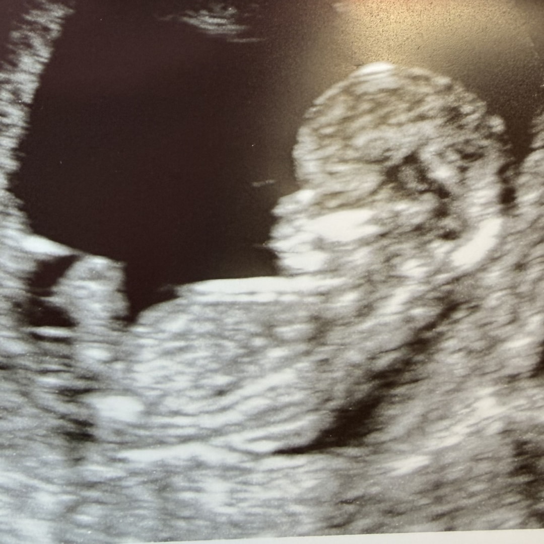 Photo shared by Brittany for their Babylist baby registry.