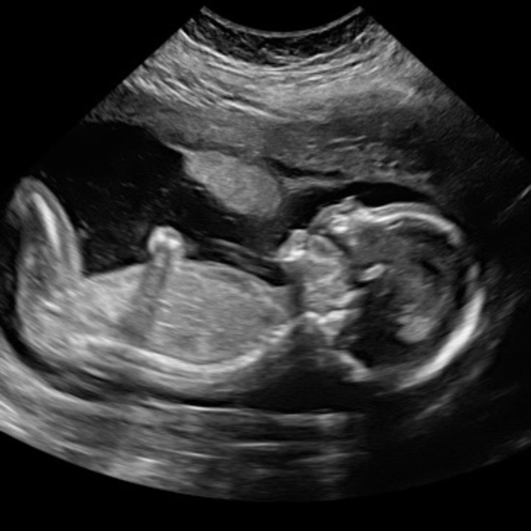 Photo shared by Melissa for their Babylist baby registry.