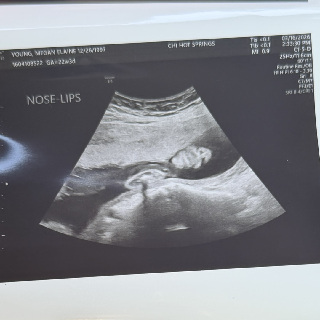 Photo shared by Megan for their Babylist baby registry.