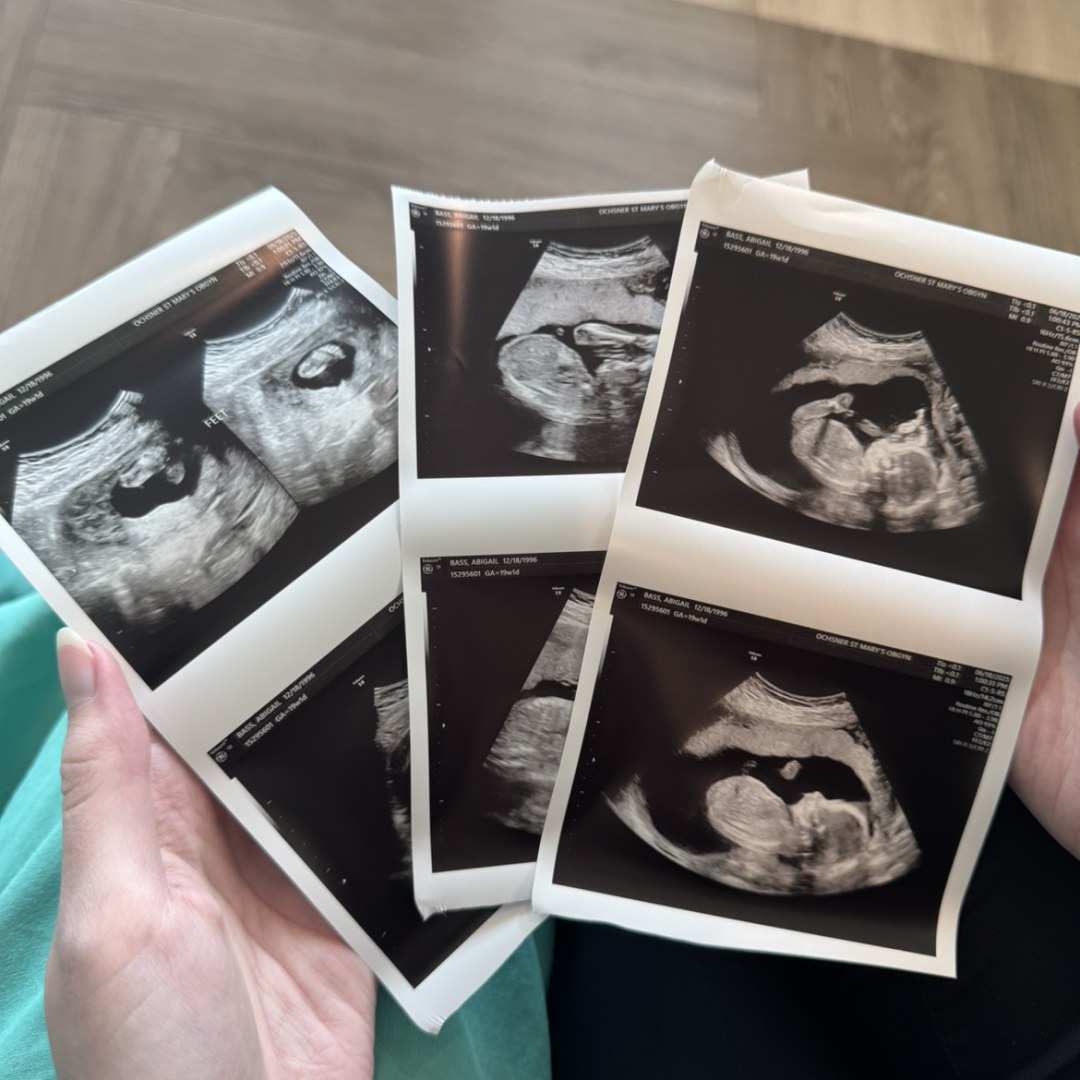 Photo shared by Abigail for their Babylist baby registry.