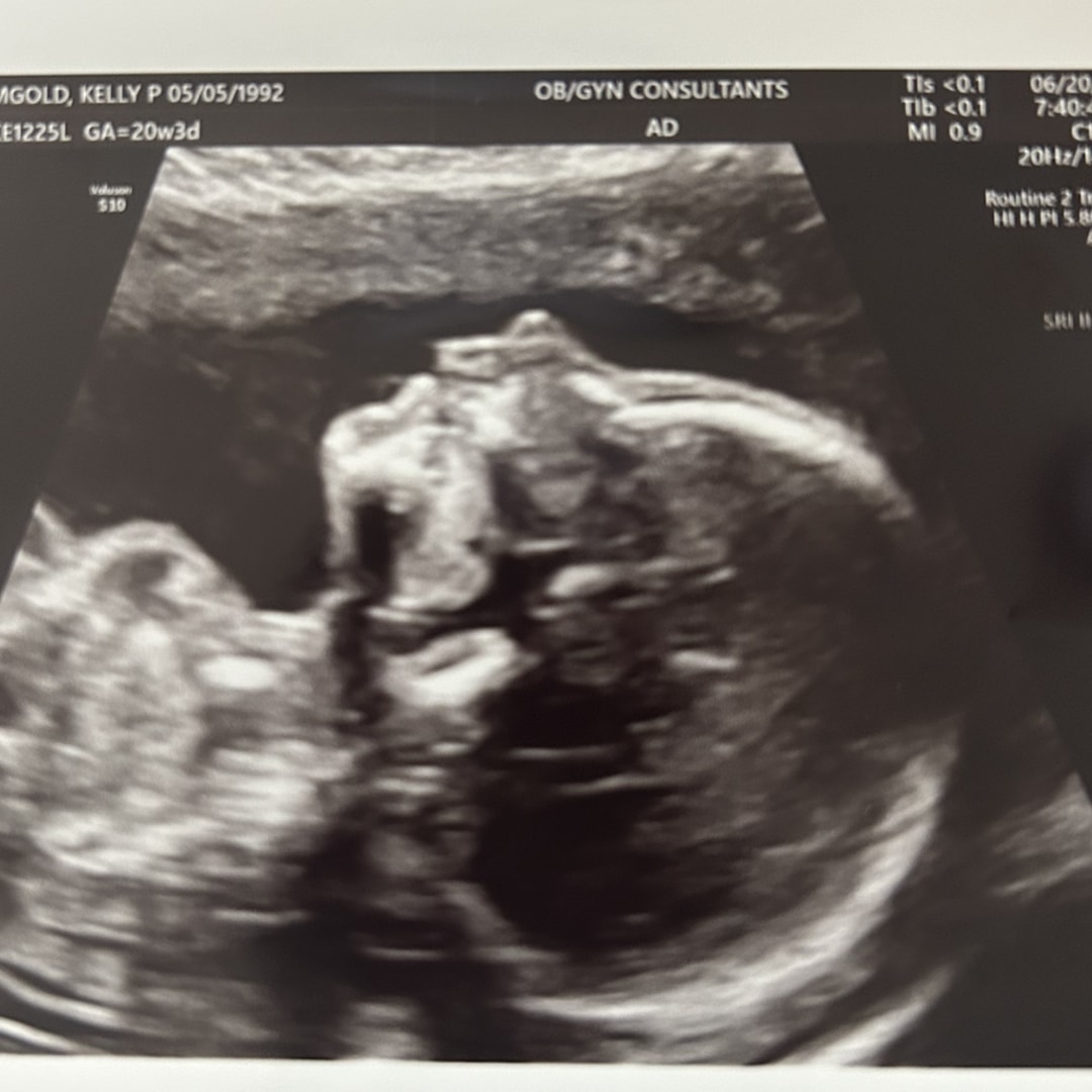 Photo shared by Kelly for their Babylist baby registry.