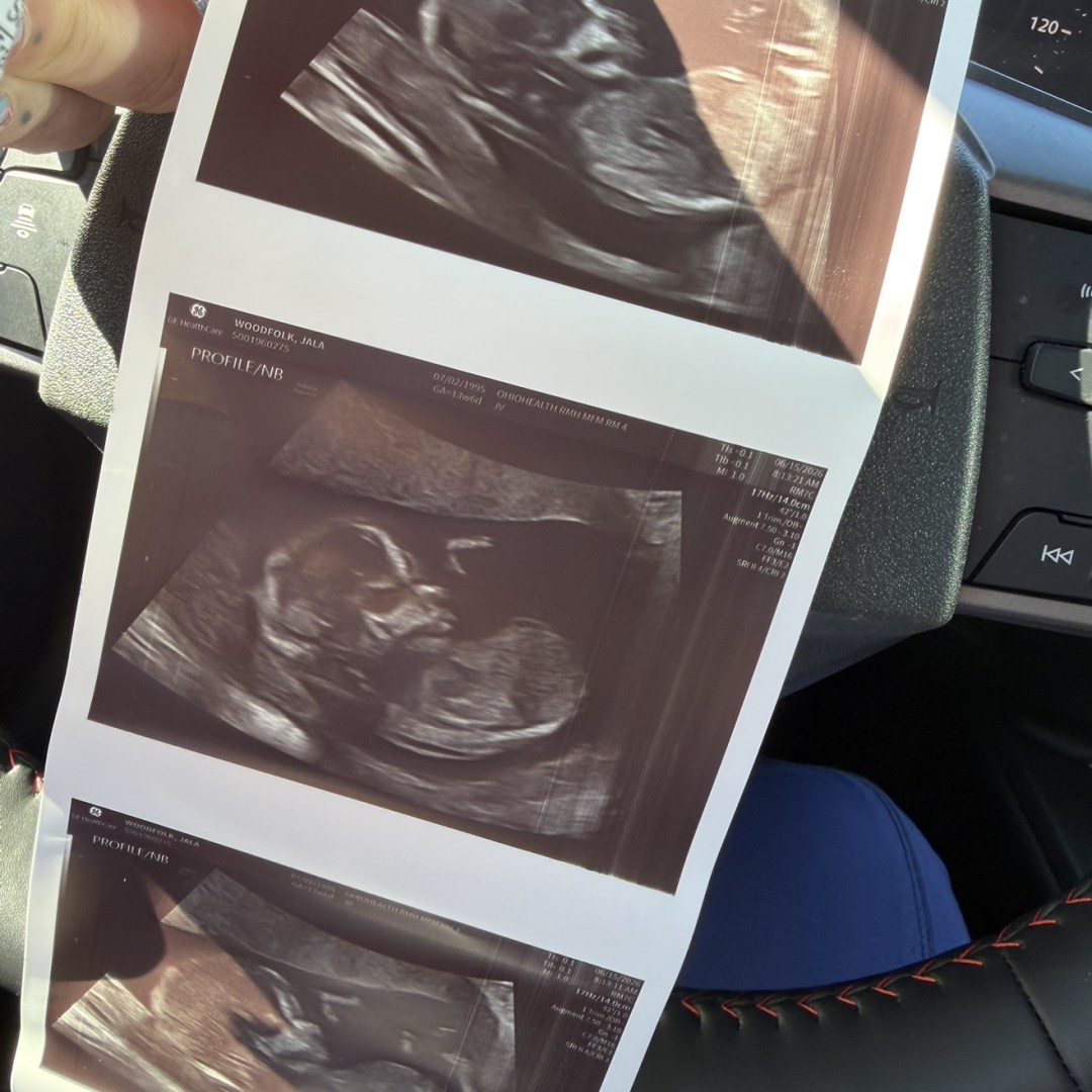 Photo shared by Jala for their Babylist baby registry.