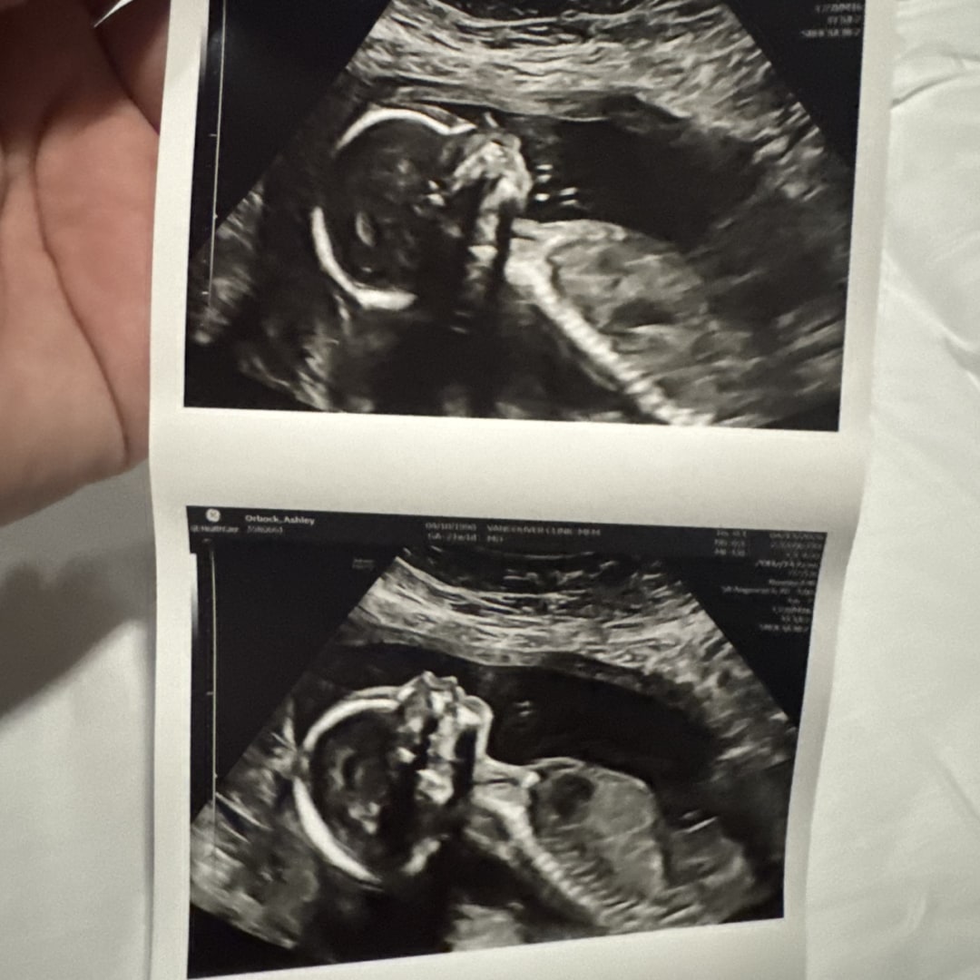 Photo shared by Ashley for their Babylist baby registry.