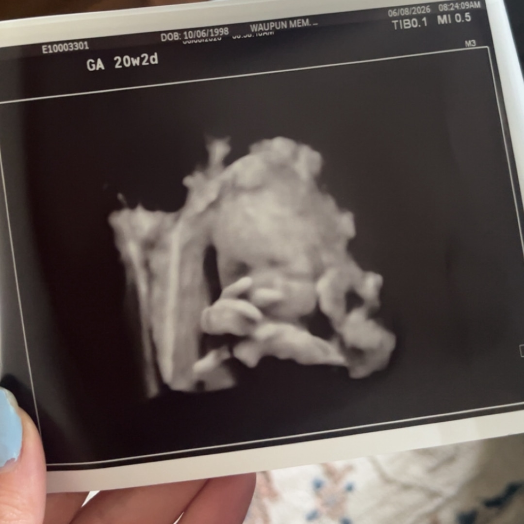 Photo shared by Erin for their Babylist baby registry.
