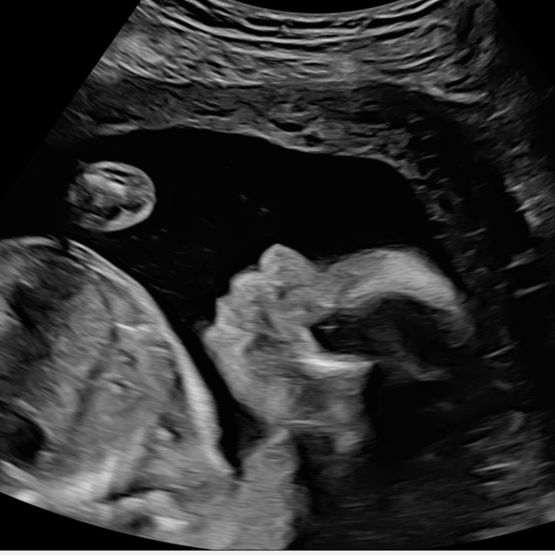 Photo shared by Angelle for their Babylist baby registry.