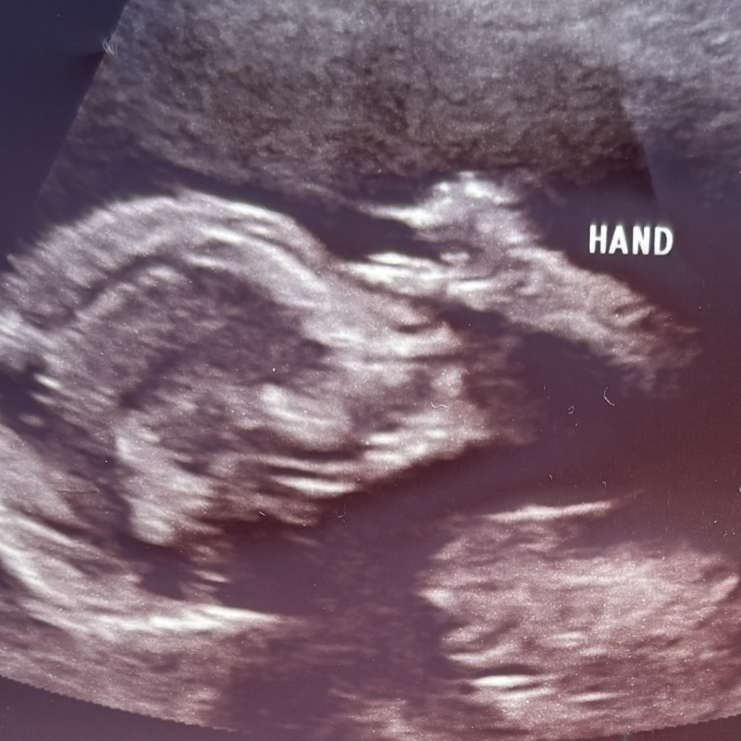 Photo shared by Daniela for their Babylist baby registry.