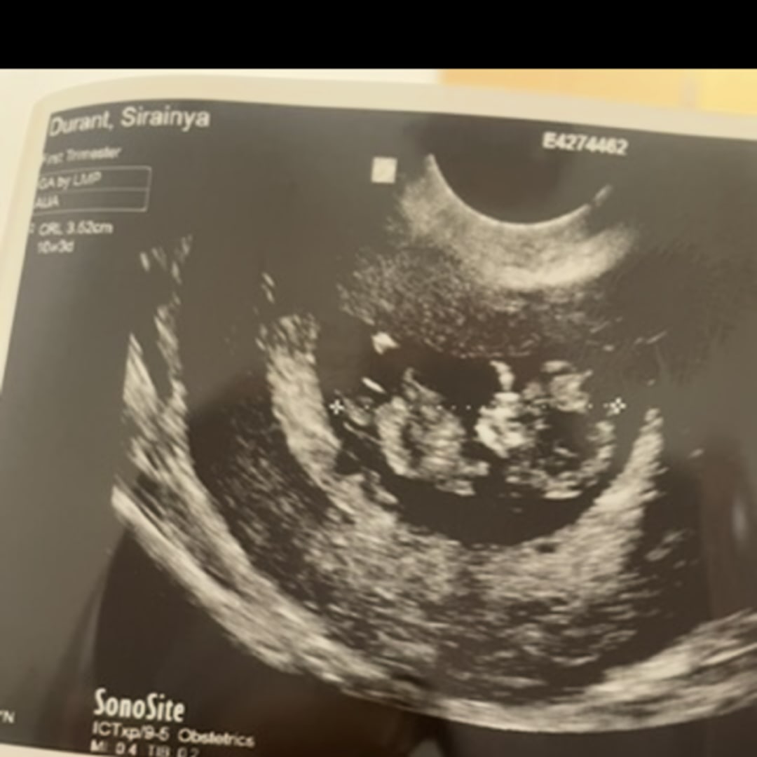 Photo shared by Sirainya for their Babylist baby registry.
