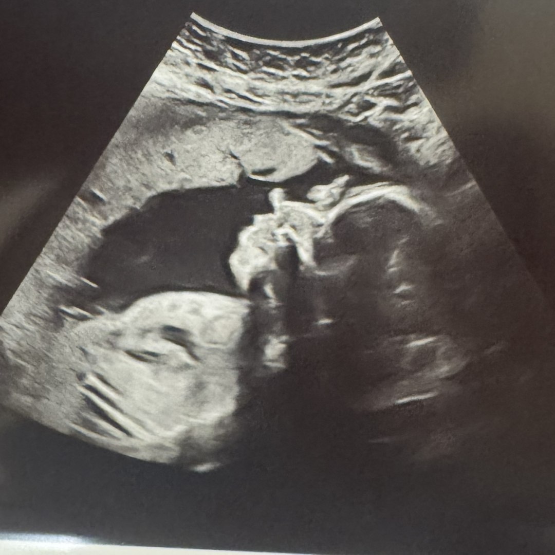 Photo shared by Rogee (Regi). for their Babylist baby registry.