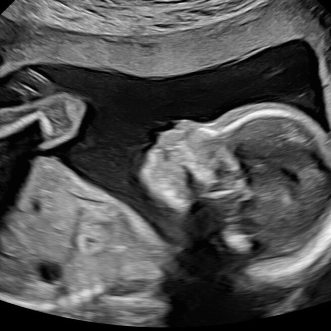 Photo shared by Mckenzie for their Babylist baby registry.