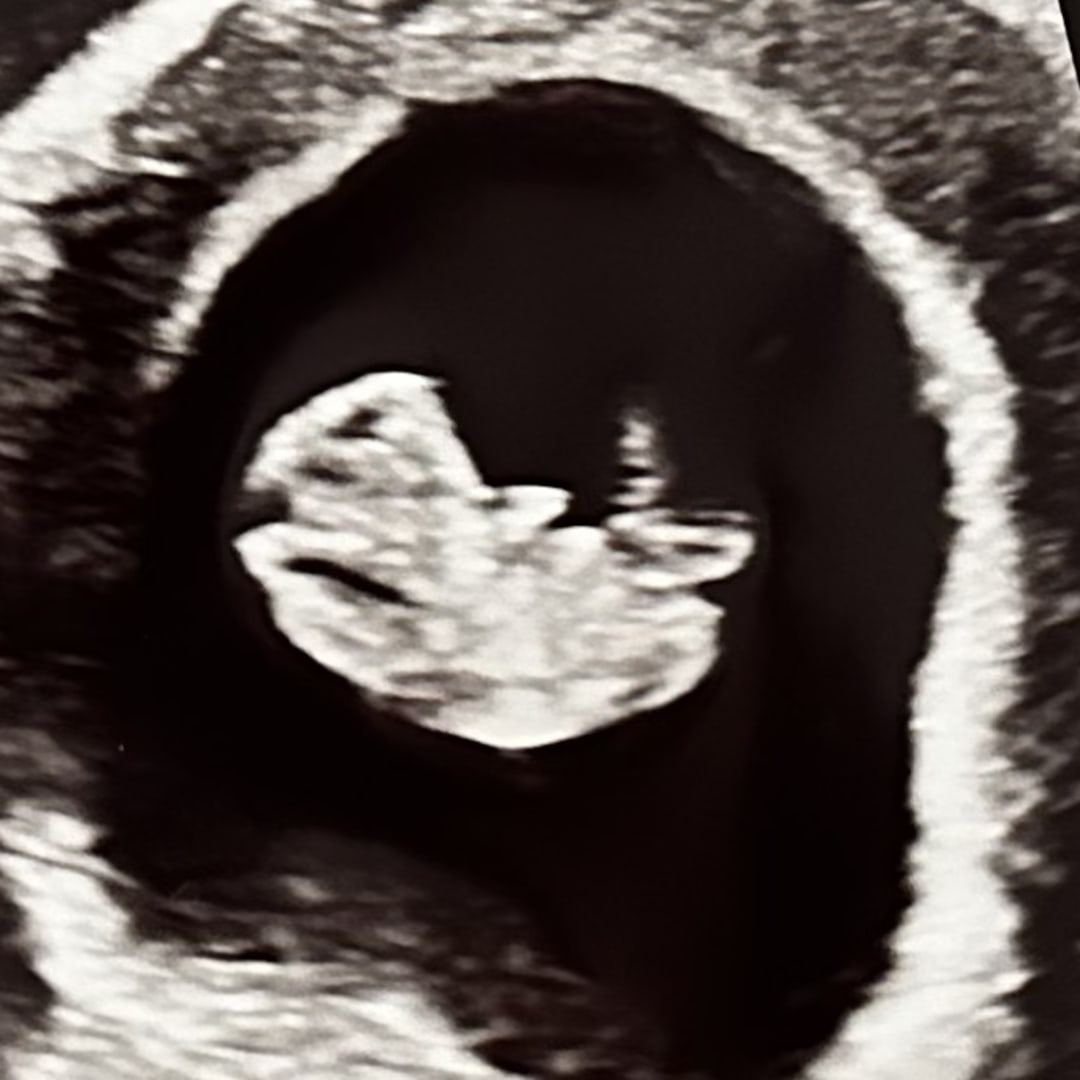 Photo shared by Shannon for their Babylist baby registry.