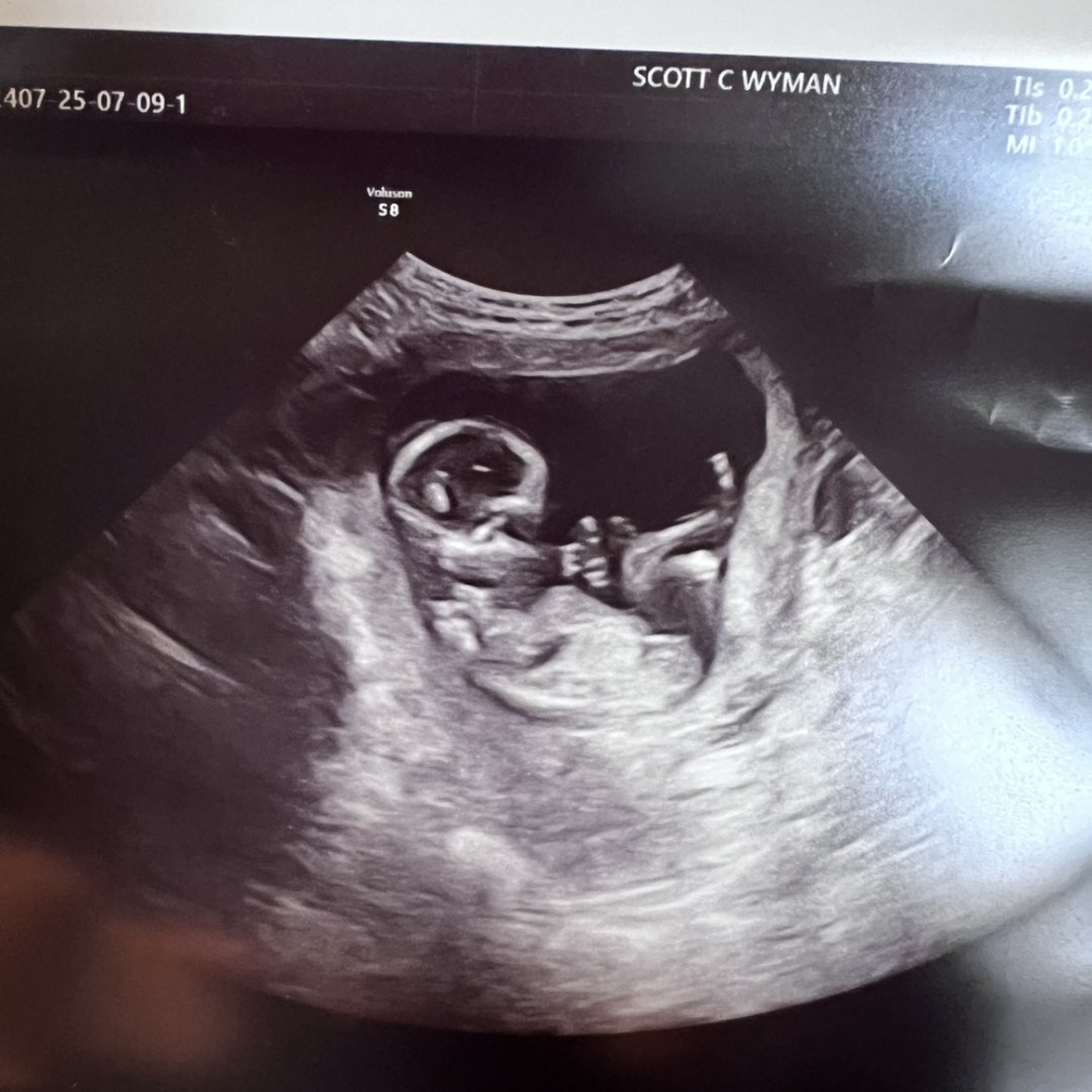 Photo shared by Megan for their Babylist baby registry.