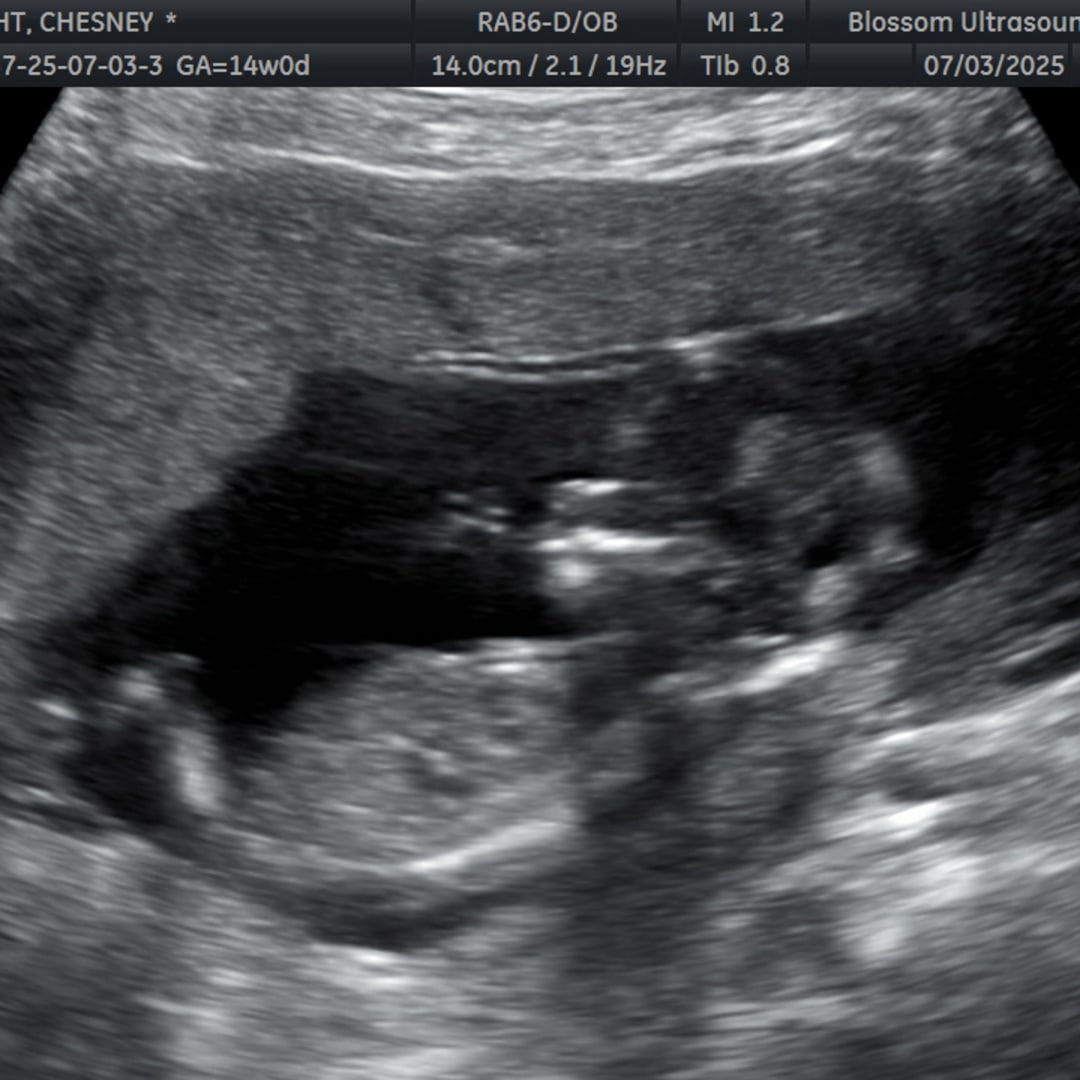 Photo shared by Chesney for their Babylist baby registry.