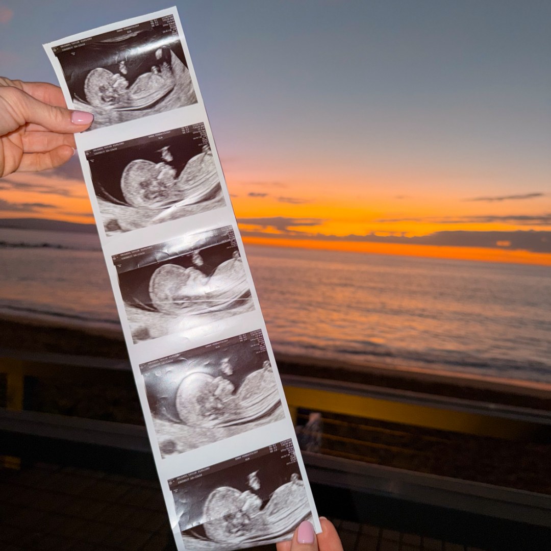 Photo shared by Taylor for their Babylist baby registry.