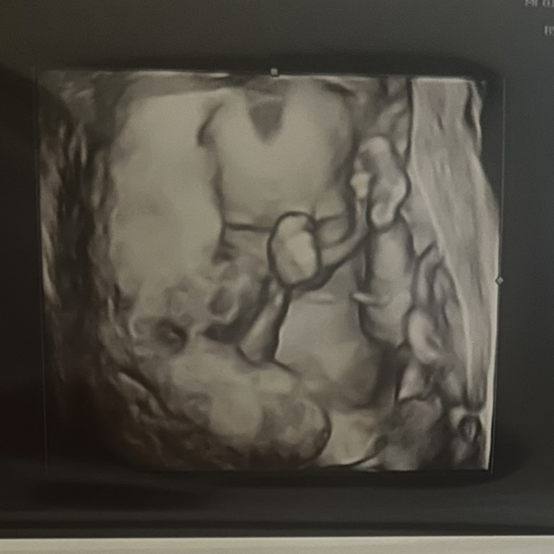 Photo shared by Yadira for their Babylist baby registry.