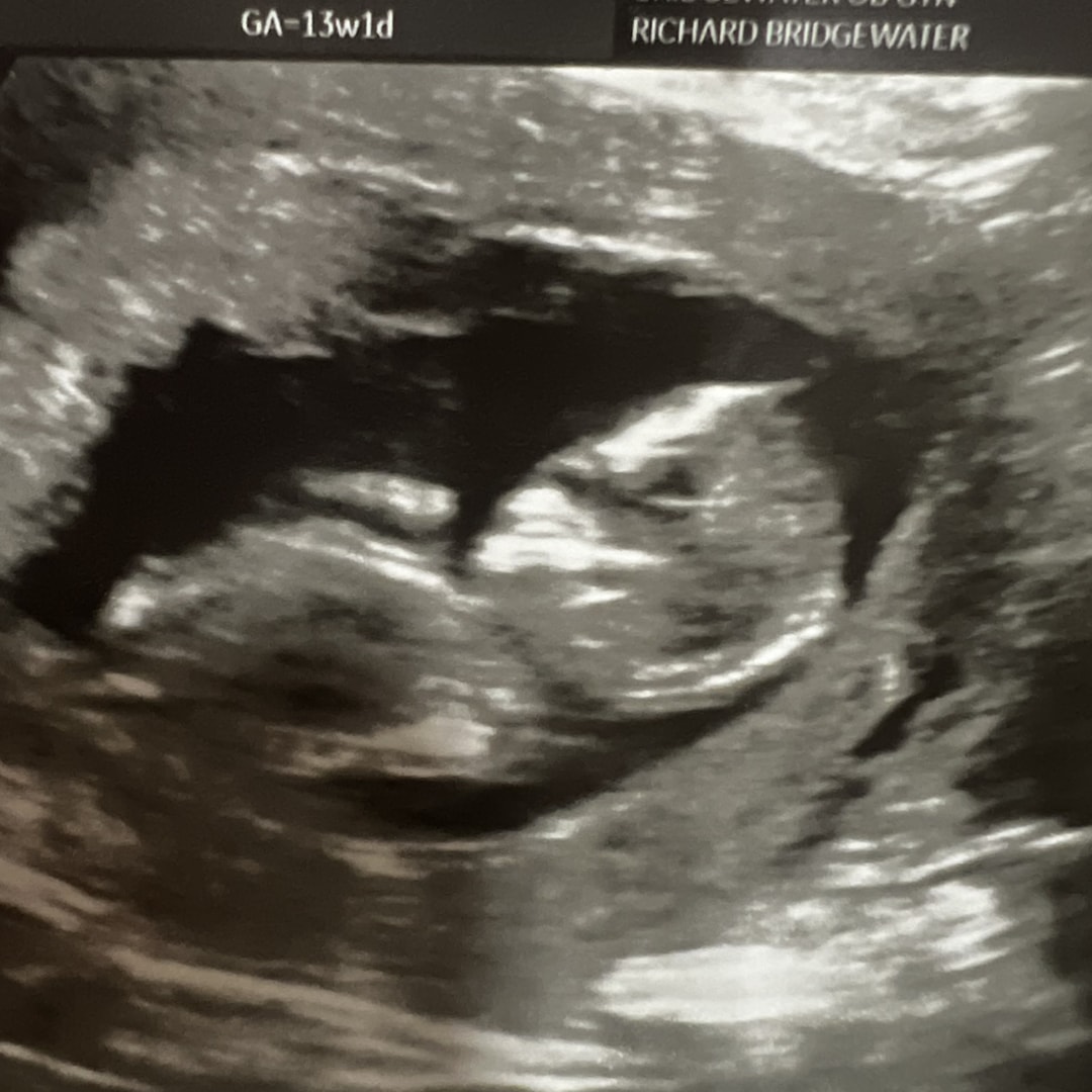 Photo shared by Ahriel for their Babylist baby registry.