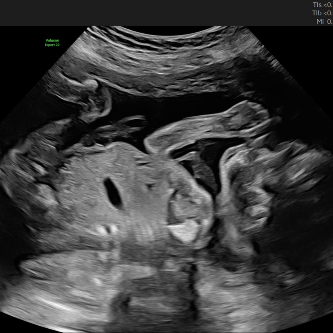 Photo shared by Bella for their Babylist baby registry.