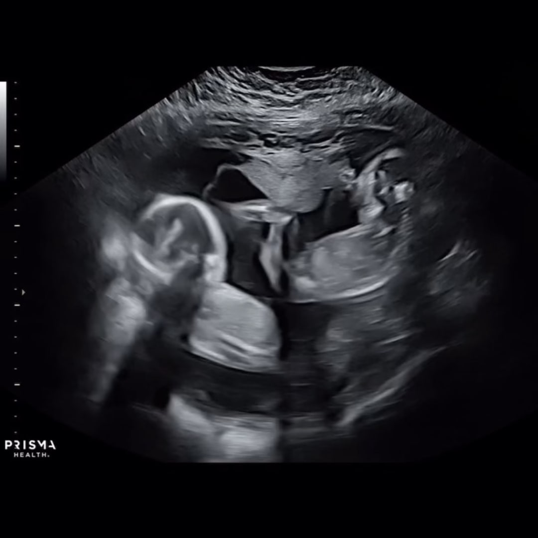 Photo shared by Katie for their Babylist baby registry.