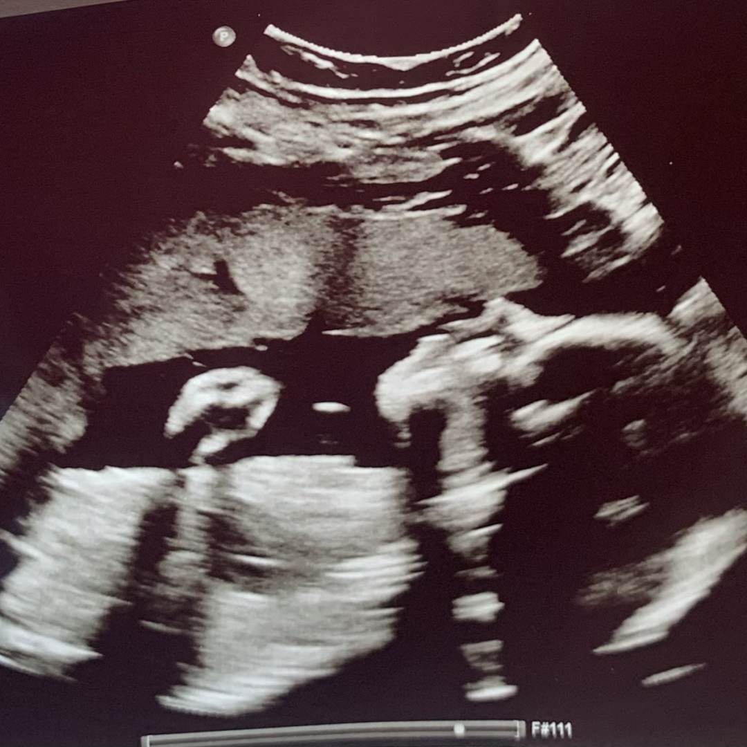 Photo shared by Chloe for their Babylist baby registry.