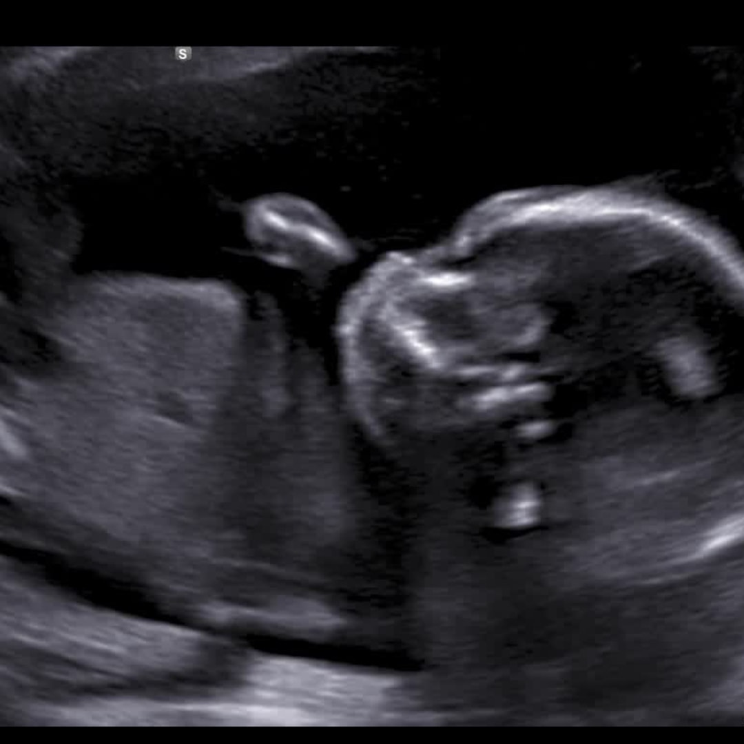 Photo shared by Alexxis for their Babylist baby registry.