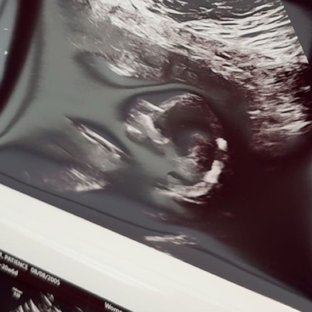 Photo shared by Christian for their Babylist baby registry.