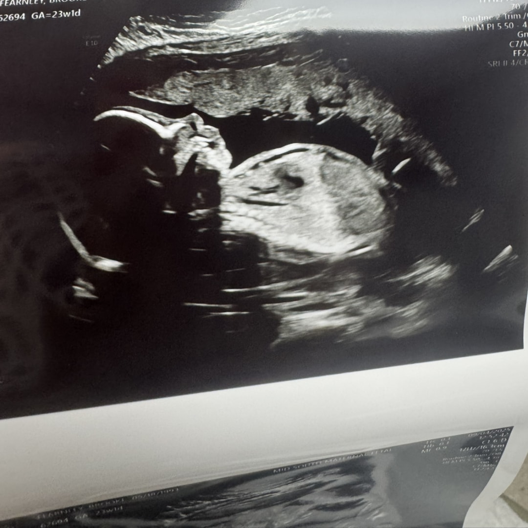 Photo shared by Brooke for their Babylist baby registry.