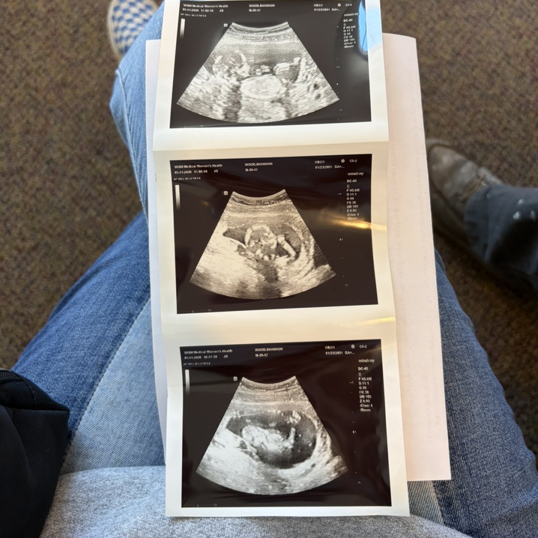 Photo shared by Shannan for their Babylist baby registry.