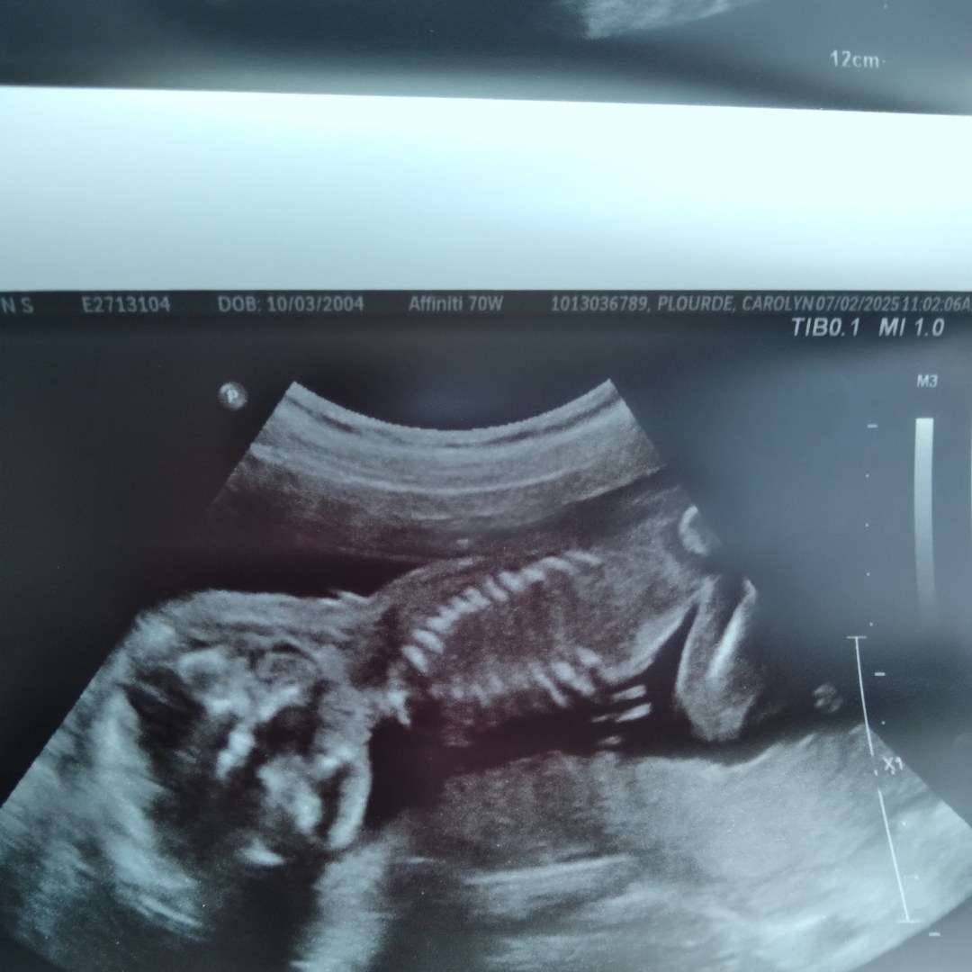 Photo shared by Daelyn for their Babylist baby registry.