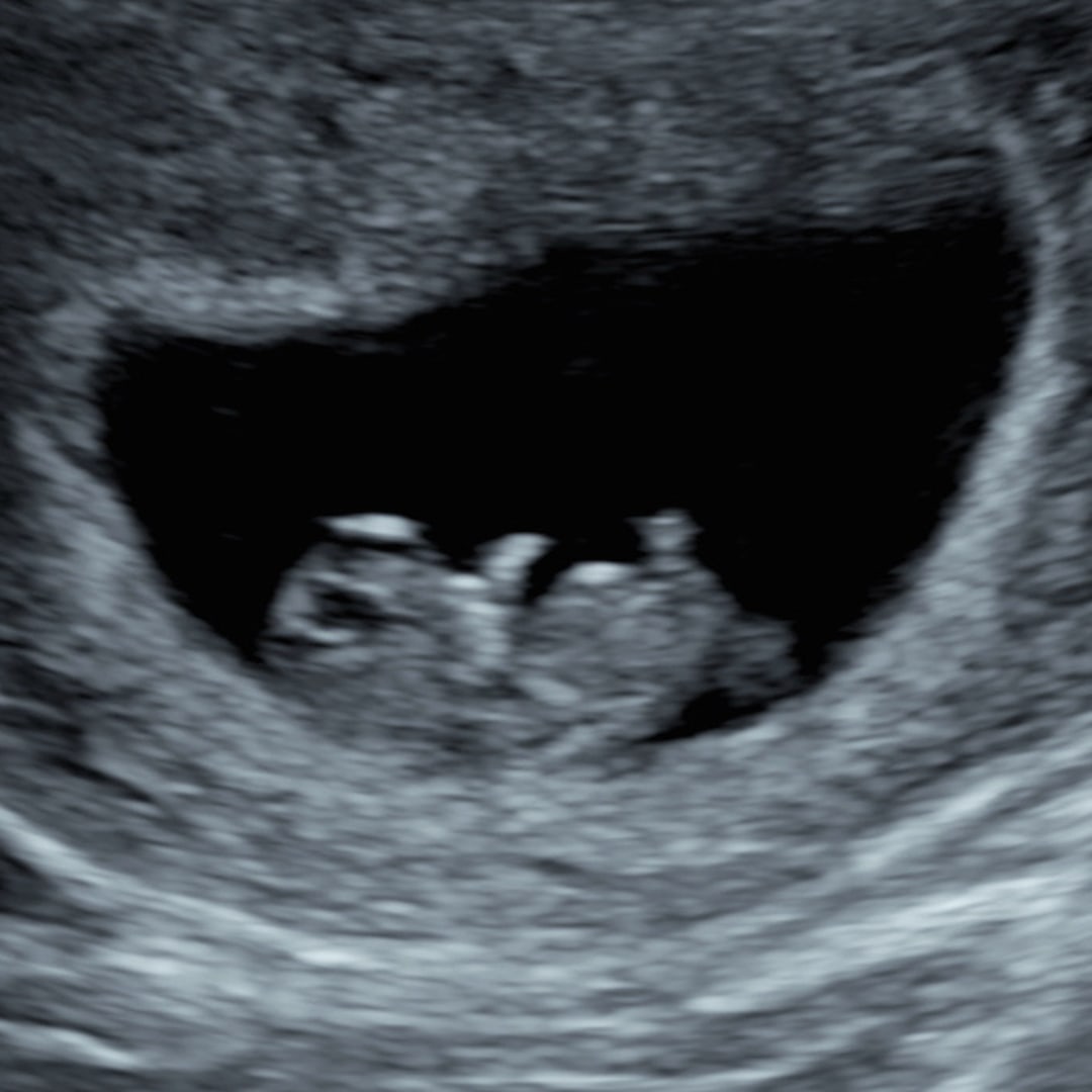 Photo shared by Riley for their Babylist baby registry.