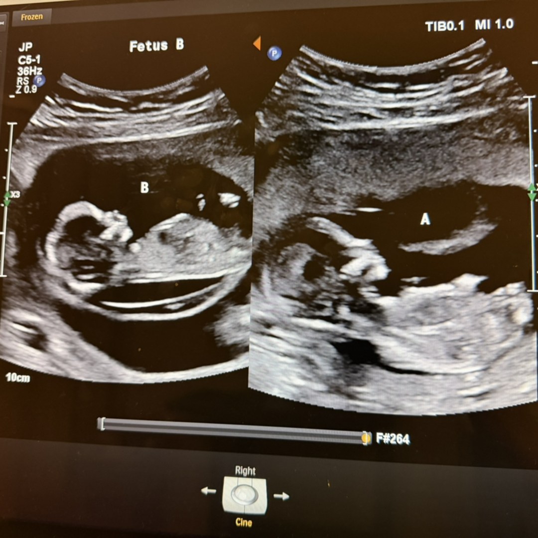 Photo shared by Seana for their Babylist baby registry.