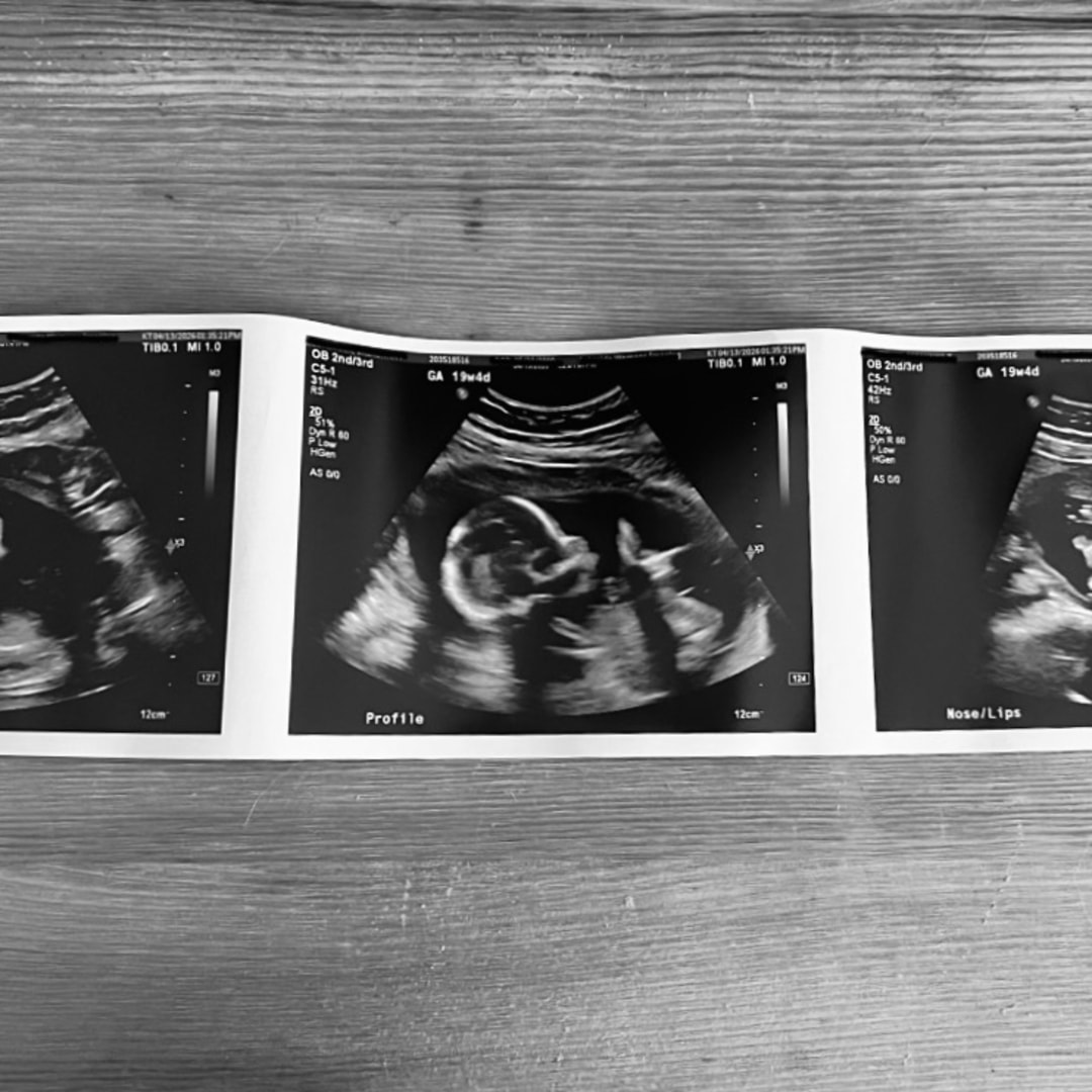 Photo shared by Breaunna for their Babylist baby registry.