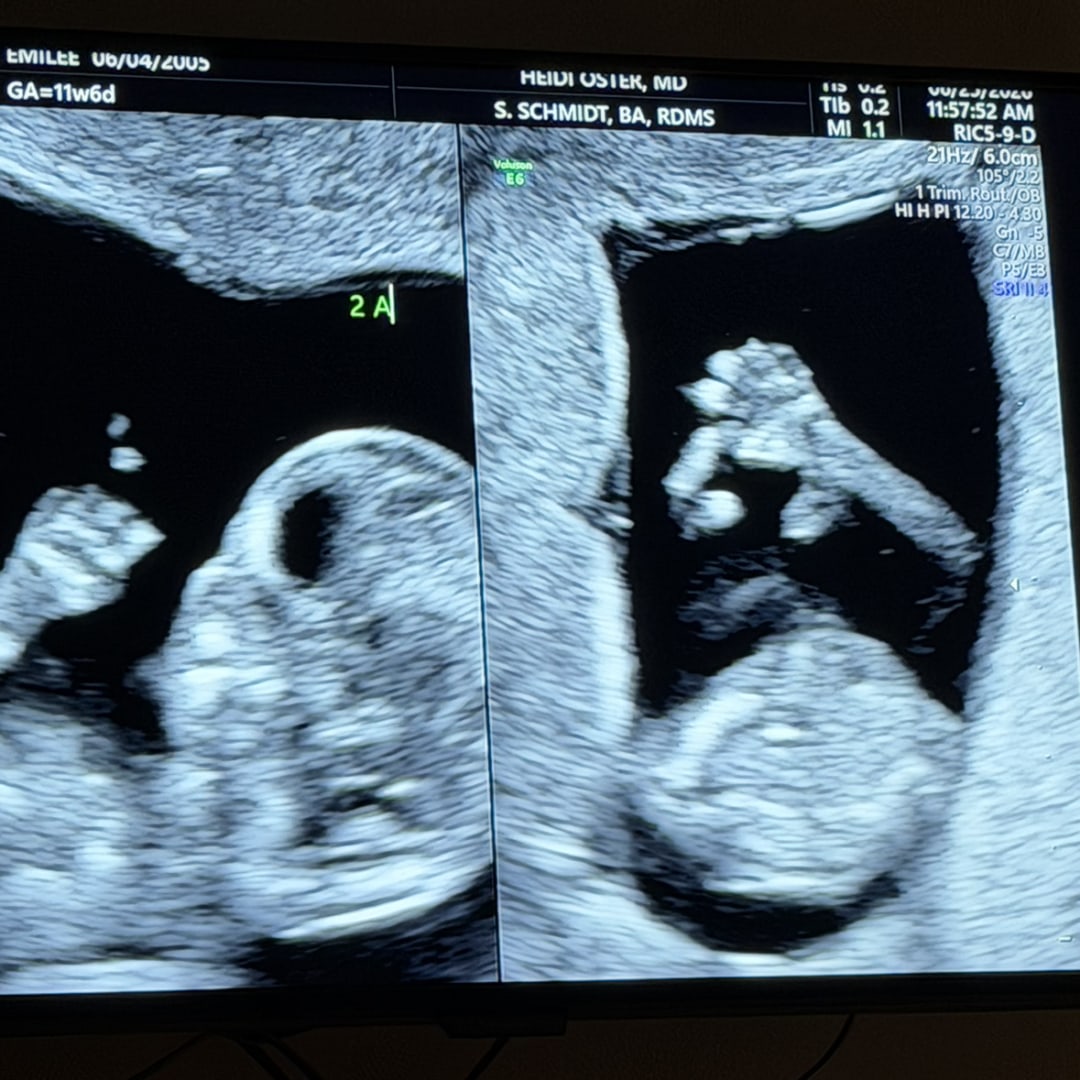 Photo shared by Emilee for their Babylist baby registry.