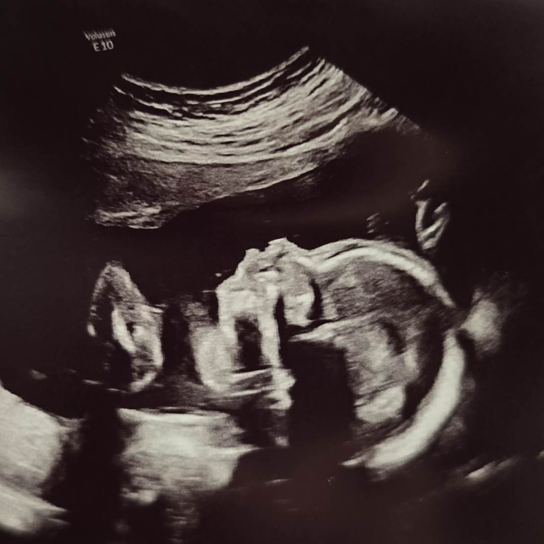 Photo shared by Mia for their Babylist baby registry.