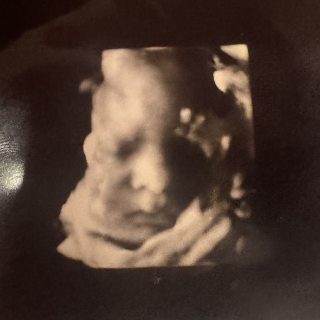 Photo shared by Grace for their Babylist baby registry.