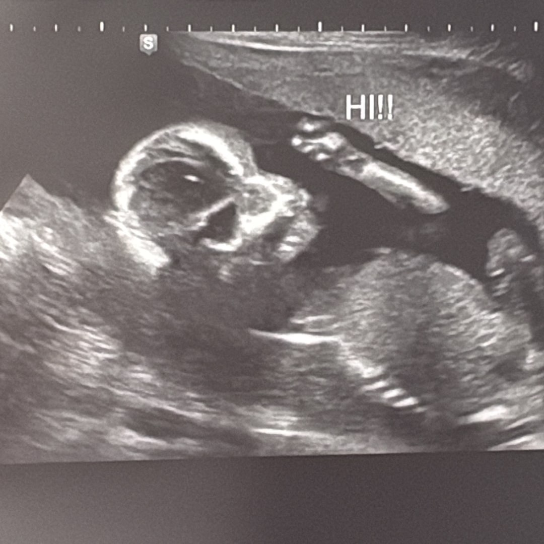 Photo shared by Angela for their Babylist baby registry.
