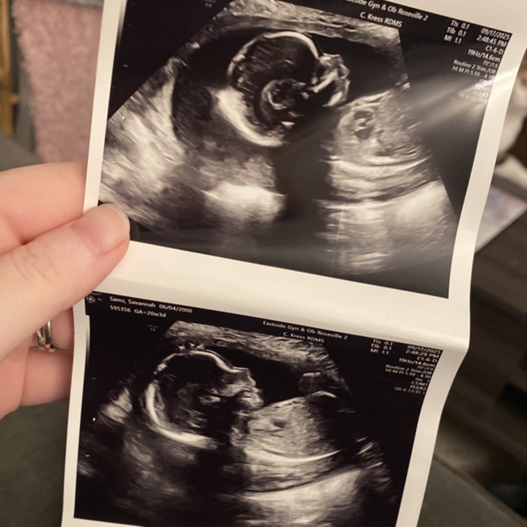 Photo shared by Savannah for their Babylist baby registry.