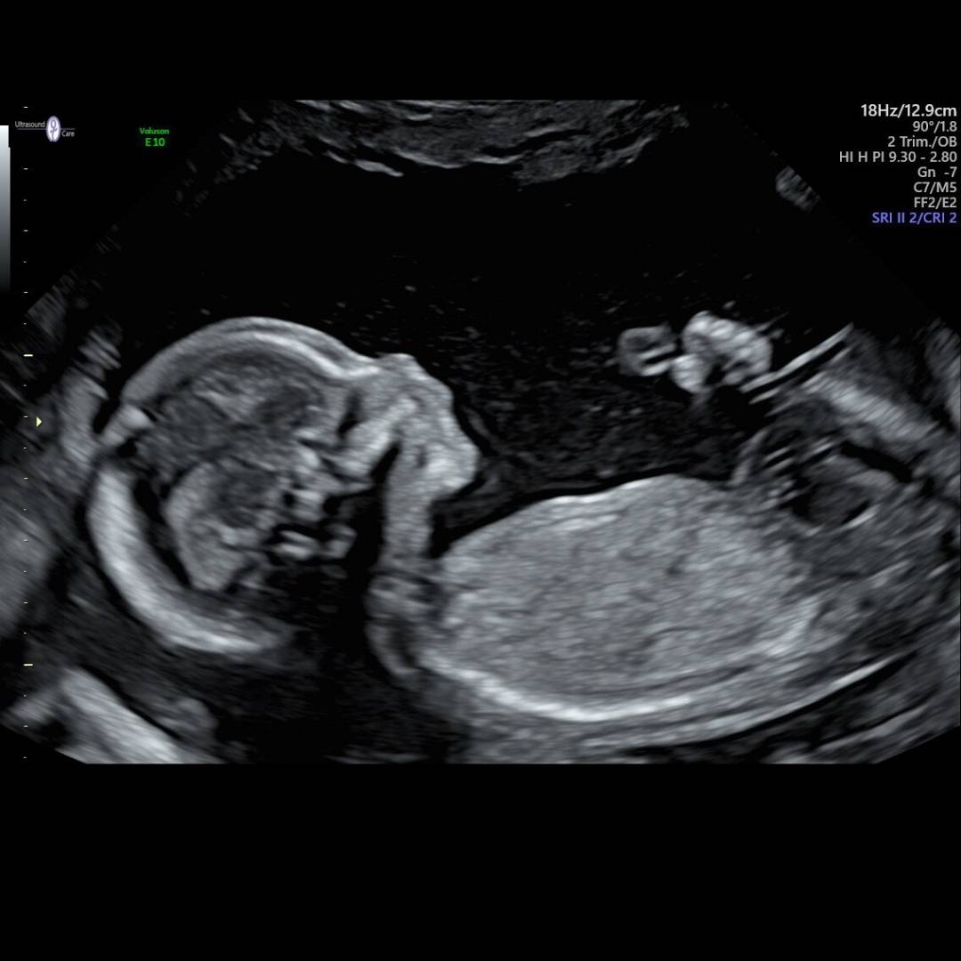 Photo shared by Sarah for their Babylist baby registry.