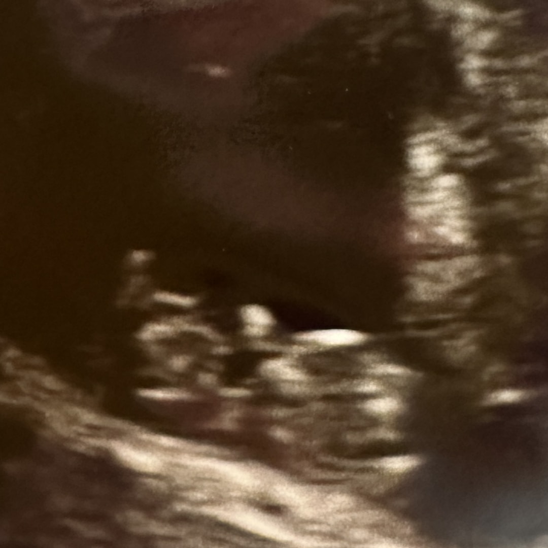 Photo shared by Kacey for their Babylist baby registry.