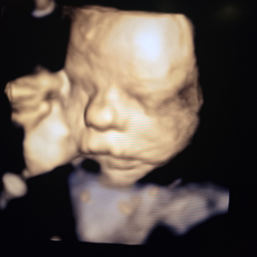 Photo shared by Samantha for their Babylist baby registry.