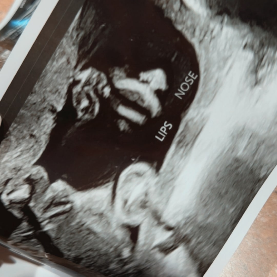 Photo shared by Jazmynn for their Babylist baby registry.