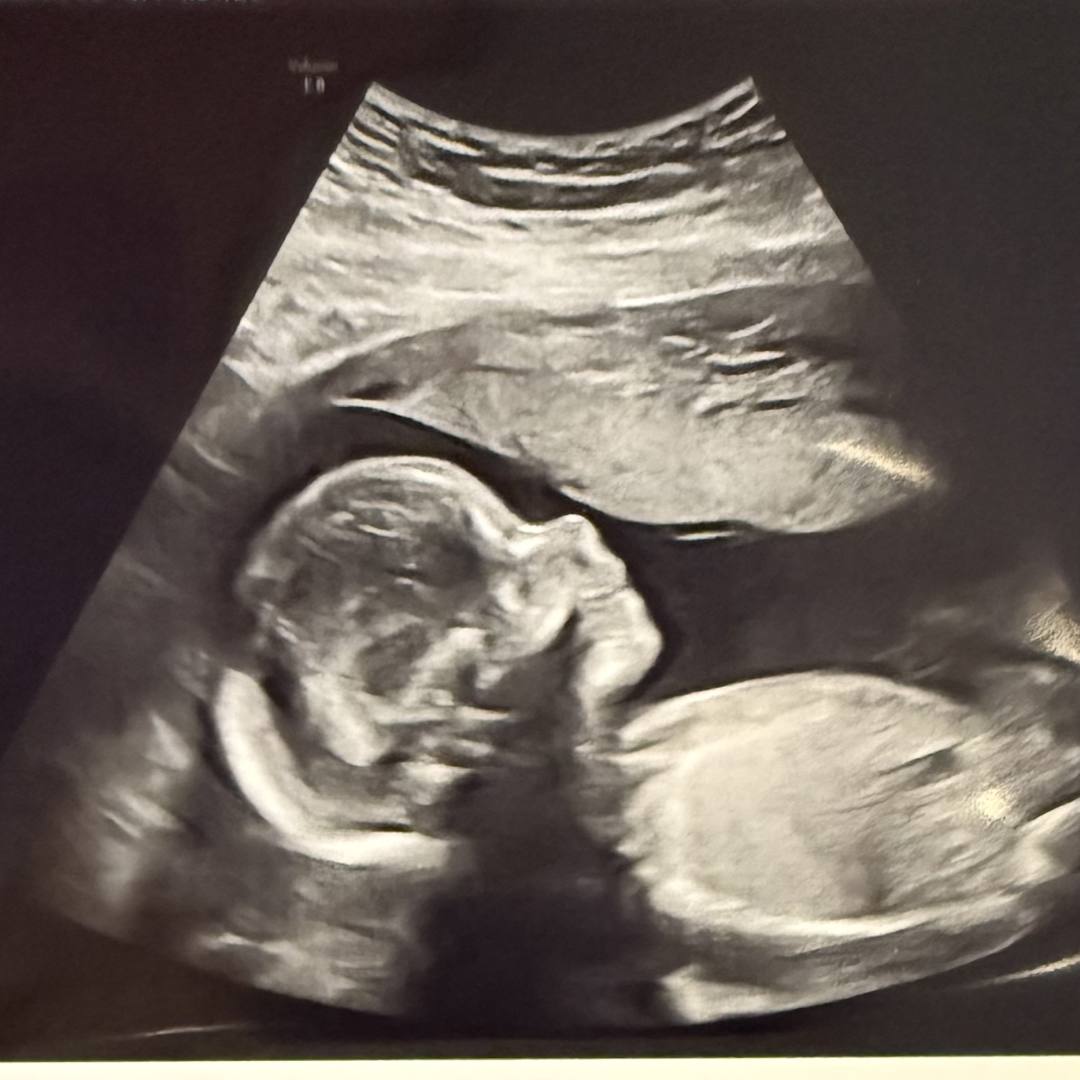 Photo shared by Taylor for their Babylist baby registry.