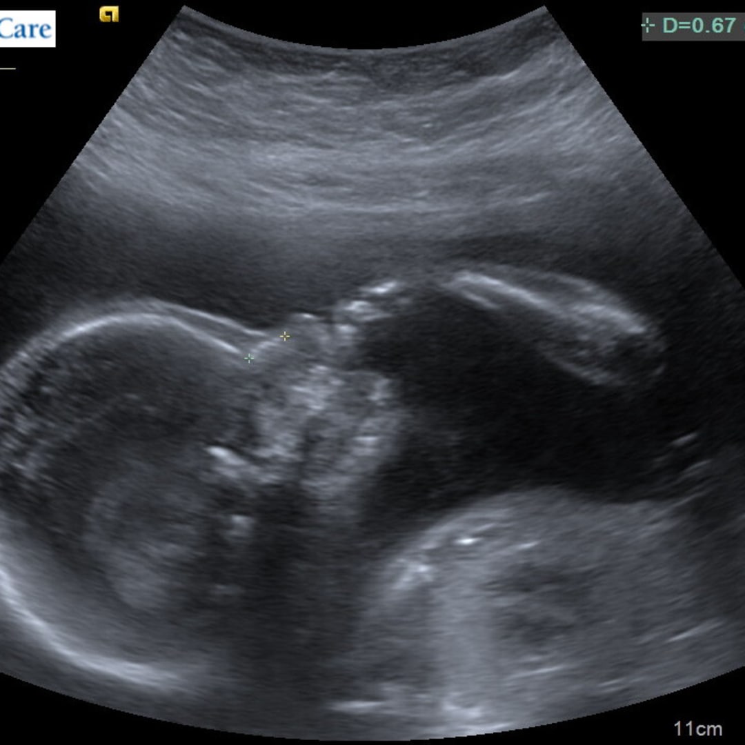 Photo shared by Athena for their Babylist baby registry.