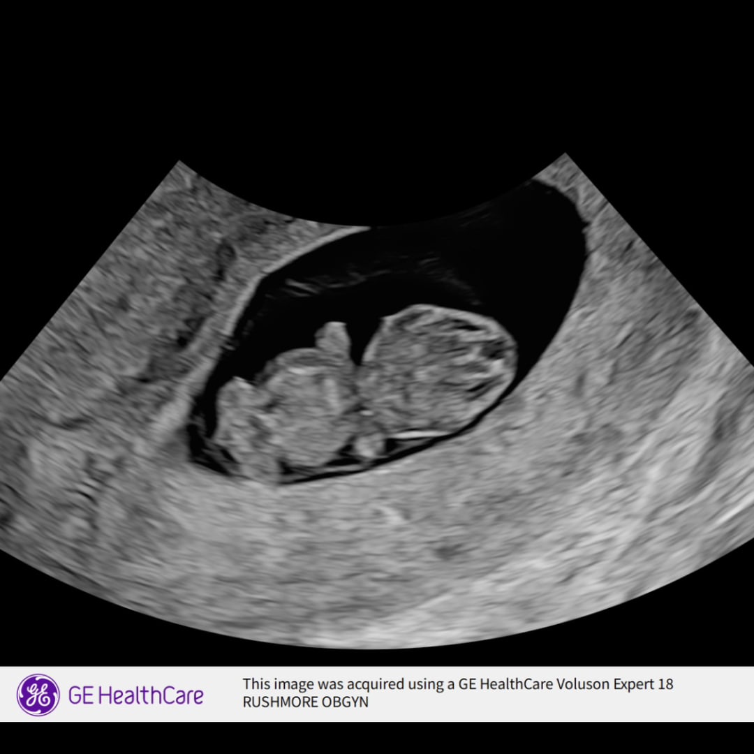 Photo shared by Kimberly for their Babylist baby registry.