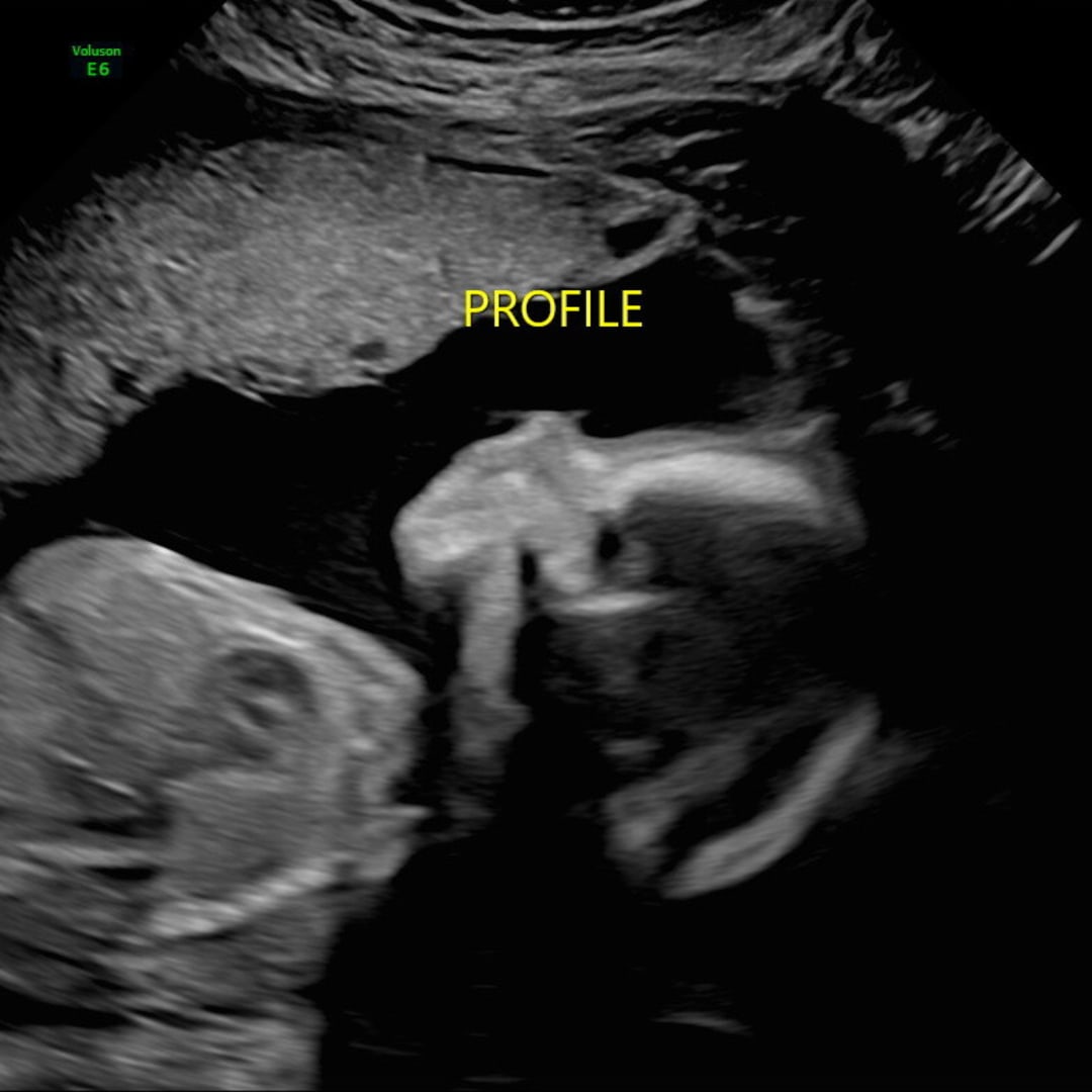Photo shared by Morgan for their Babylist baby registry.