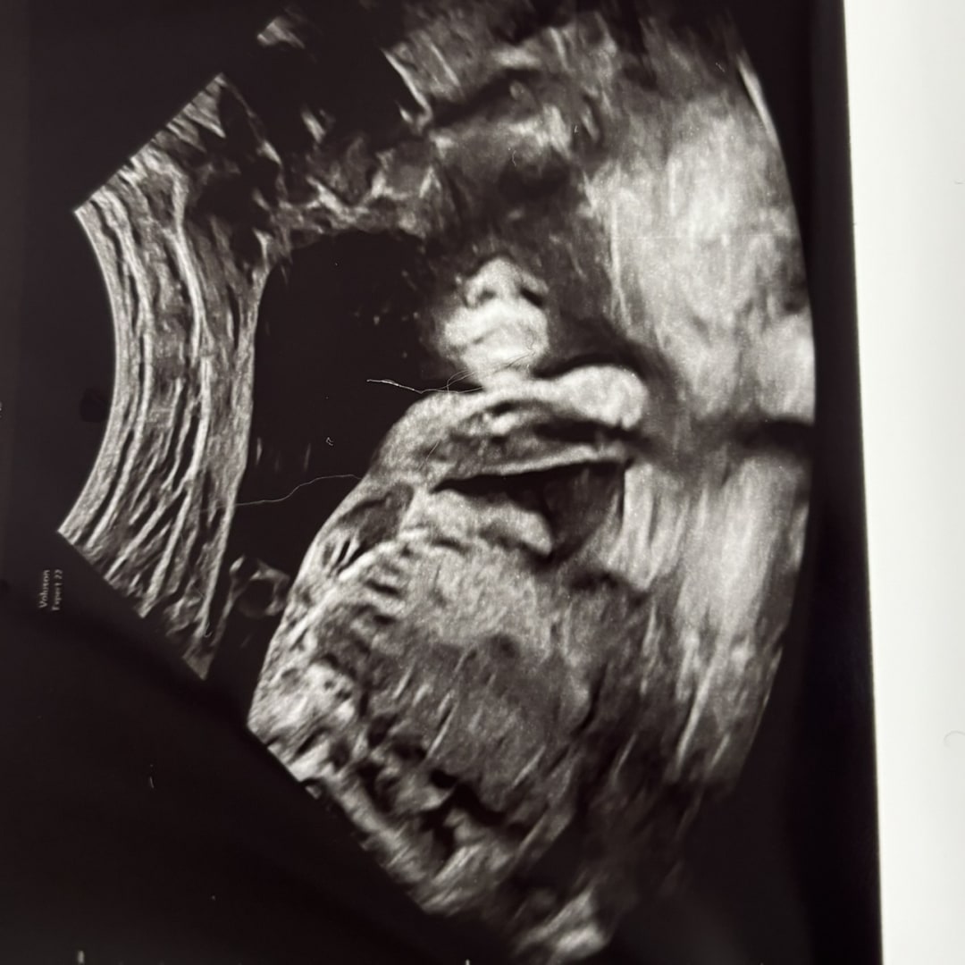 Photo shared by Kyleigh for their Babylist baby registry.