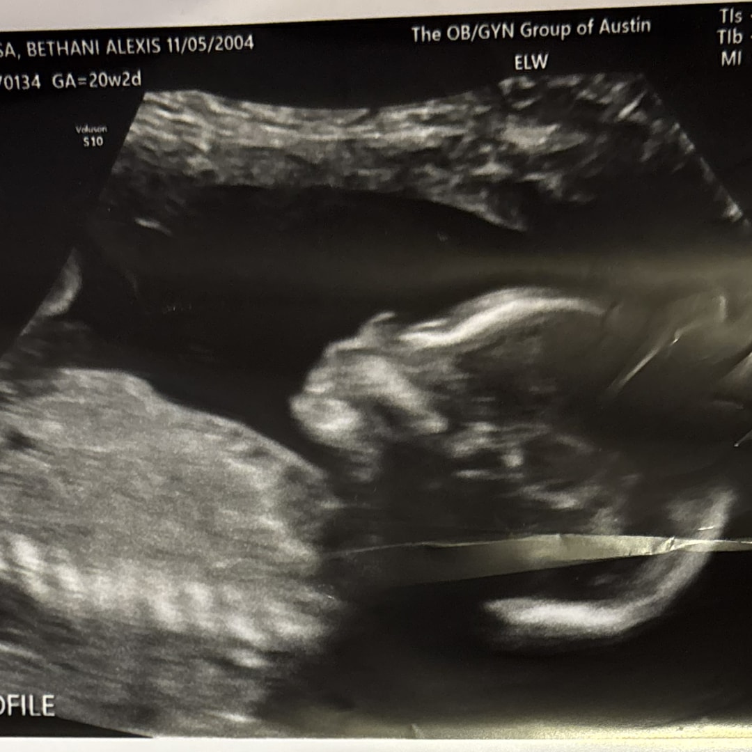 Photo shared by Bethani for their Babylist baby registry.