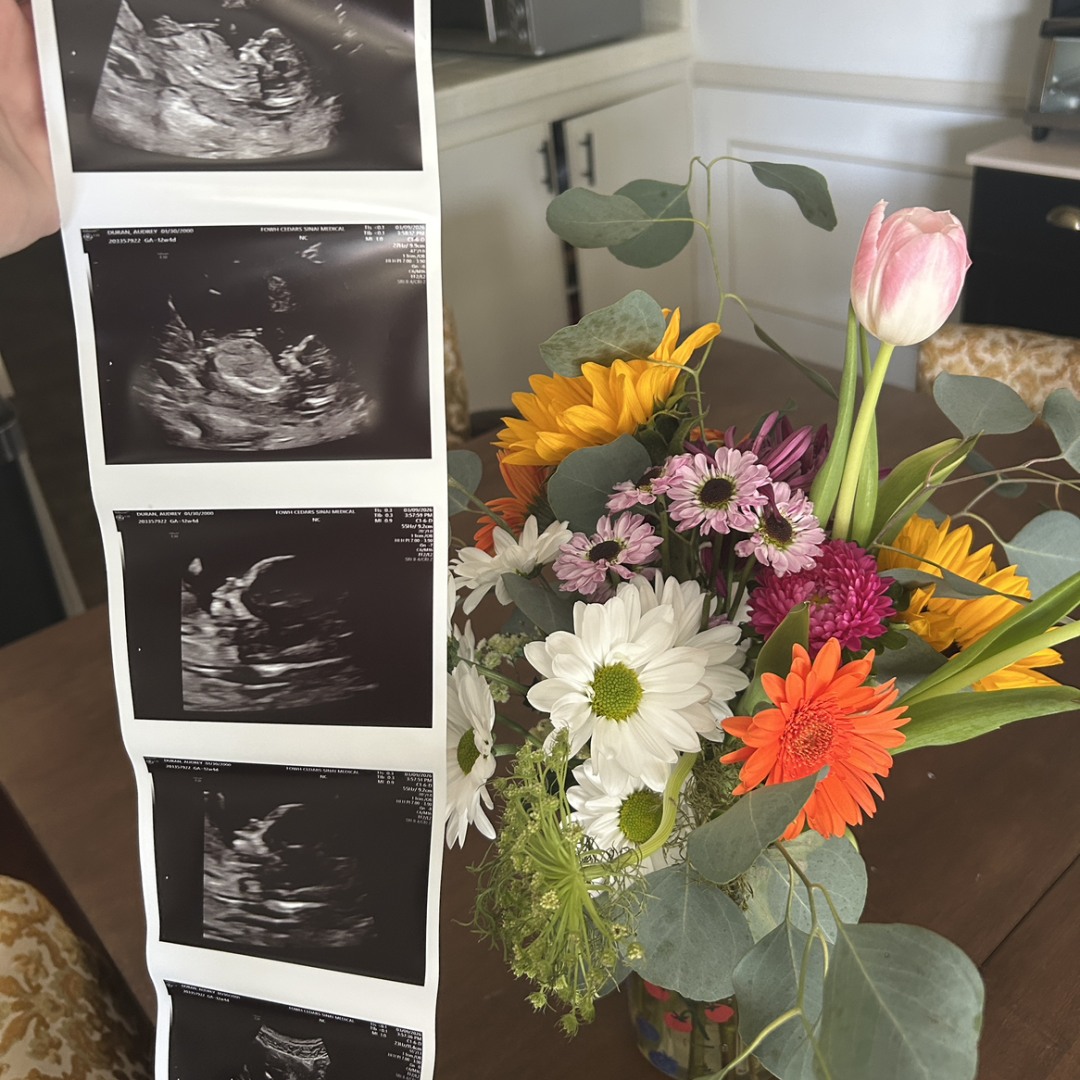 Photo shared by Audrey for their Babylist baby registry.