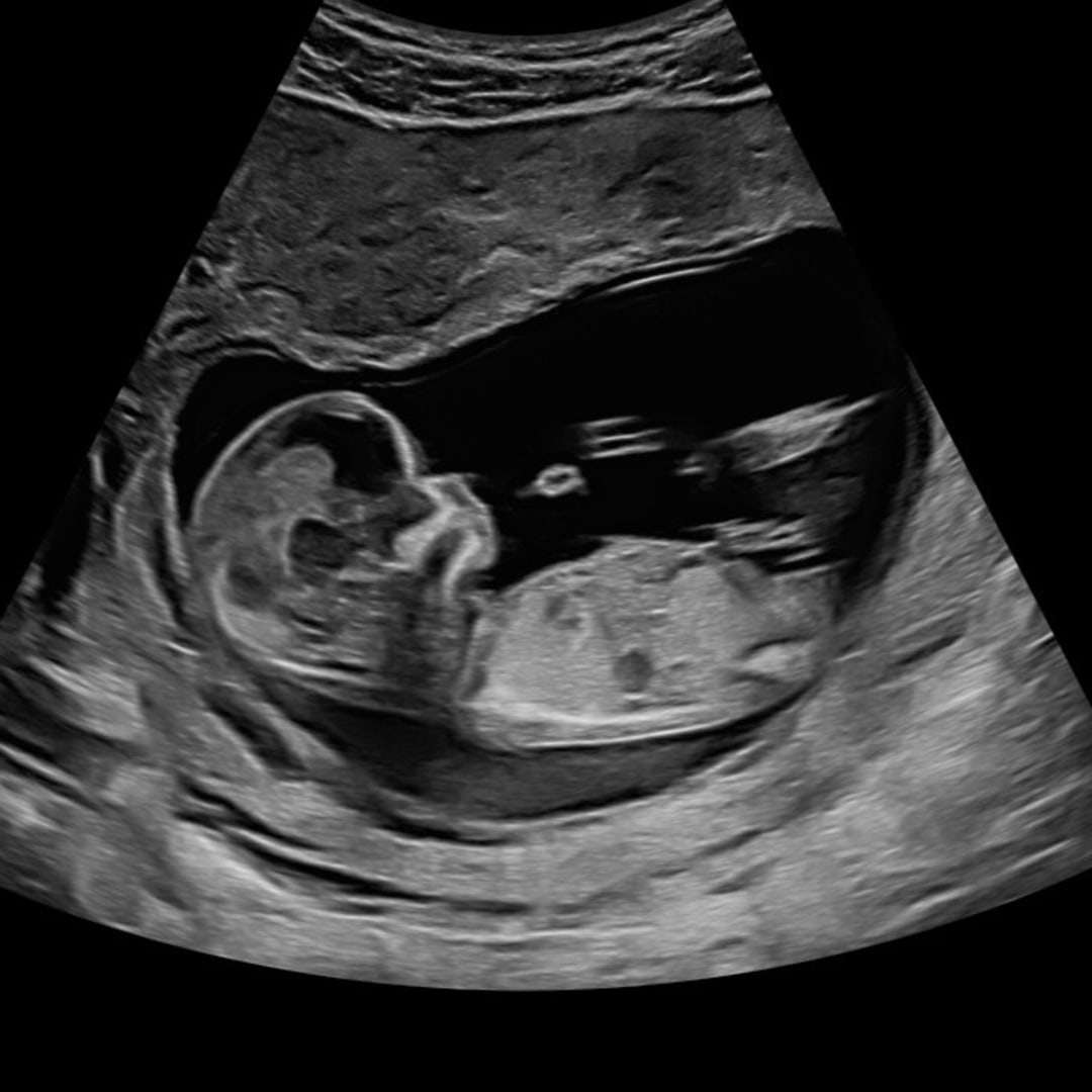 Photo shared by Sam, Evan for their Babylist baby registry.