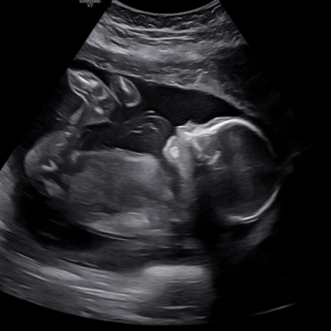 Photo shared by Rachael for their Babylist baby registry.